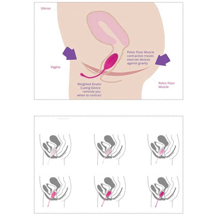 Censan Rose 6lı Kegel Egzersiz Topu