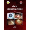 GÜNCEL VİTREORETİNAL CERRAHİ