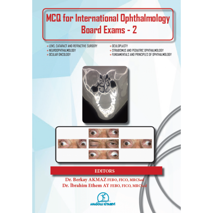 MCQ FOR INTERNATIONAL OPHTHALMOLOGY BOARD EXAMS - 2