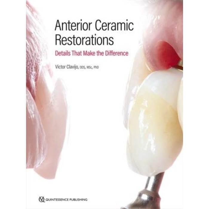 ANTERİOR CERAMİC RESTORATİONS