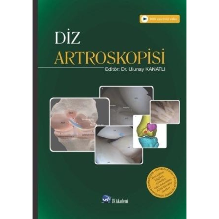 DİZ ARTROSKOPİSİ