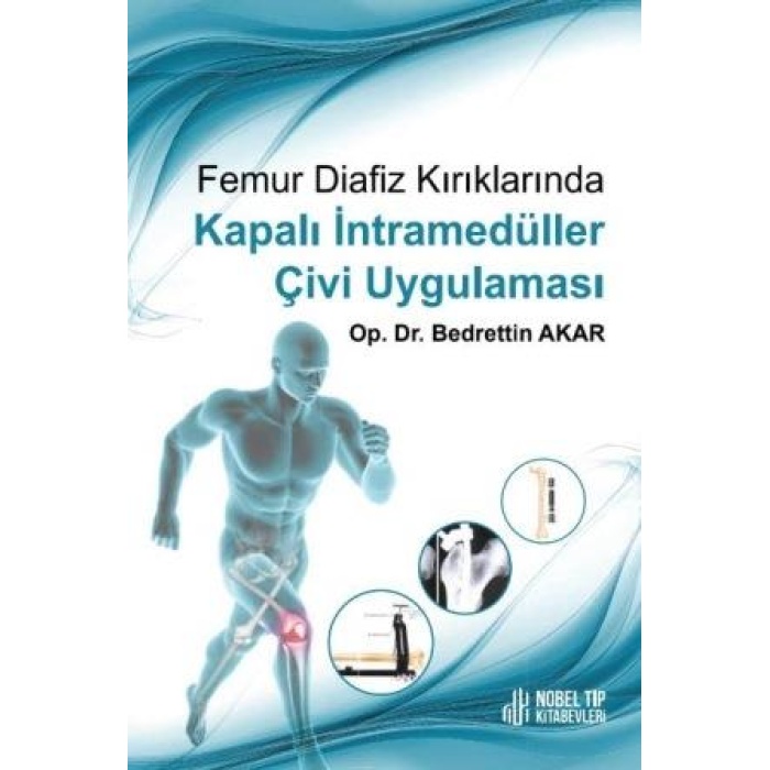 FEMUR DİAFİZ KIRIKLARINDA KAPALI İNTRAMEDÜLLER ÇİVİ UYGULAMASI