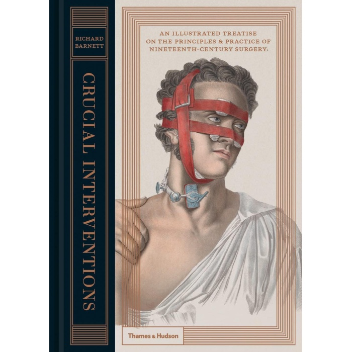 Interons: An Illustrated Treatise on the Principles & Practice of Nineteenth-Century Surgery.