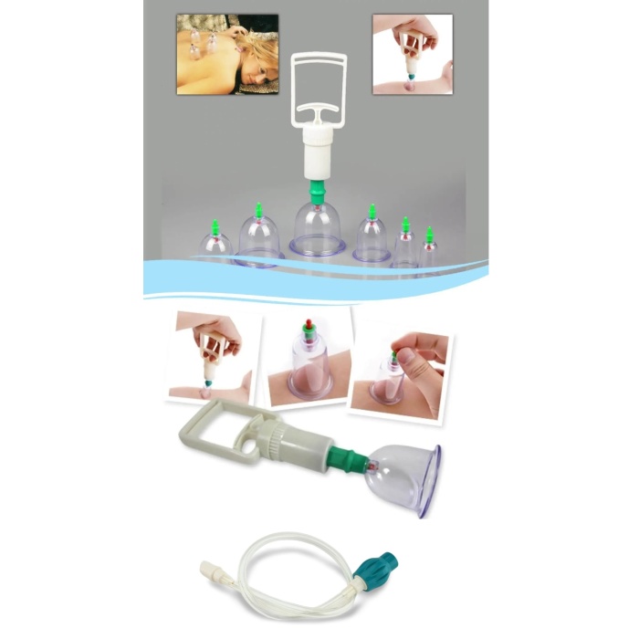 Hacamat Seti Hortumlu - Vakumlu Hortumlu Kupa Çekme Seti (Model 3) (7474)